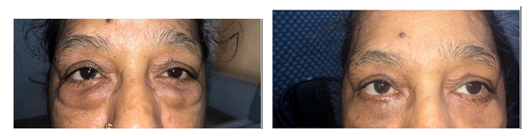 Cosmetic procedures