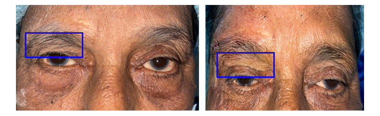 Cosmetic procedures