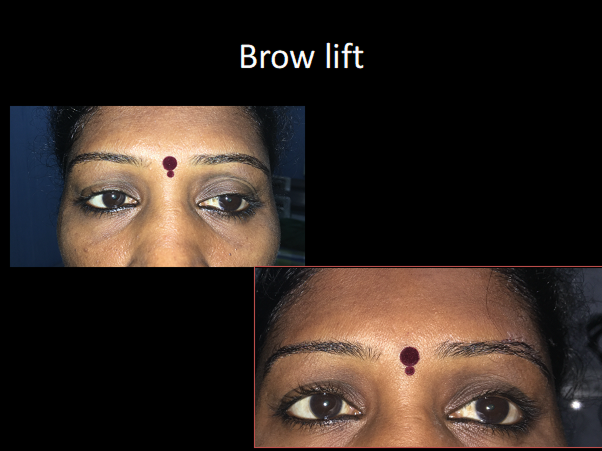 Cosmetic procedures